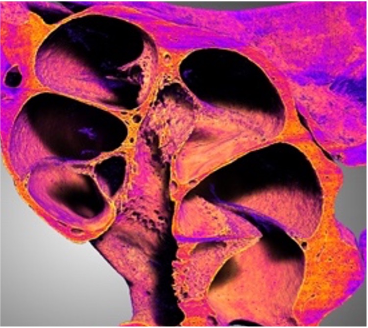 Congrats to ConnorK and Christoforos for winning 1st place in the 2023 UCSF-Broad Image Contest!